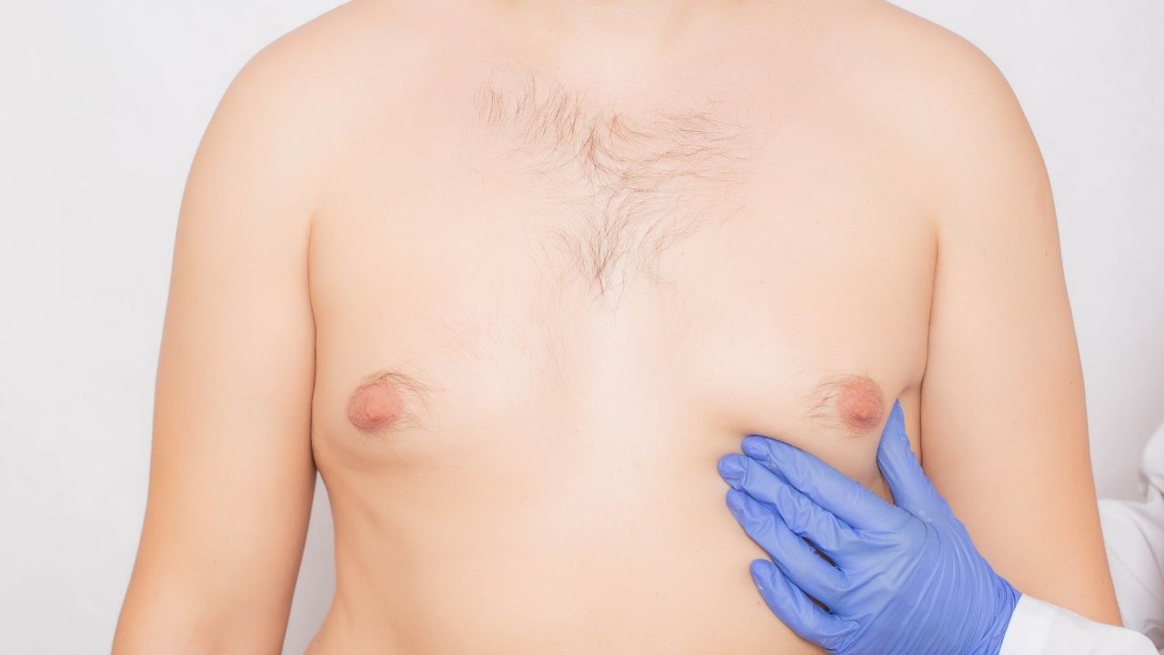 gynecomastiasurgery.jpg