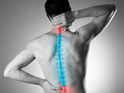 scoliosissurgeryinformations.webp